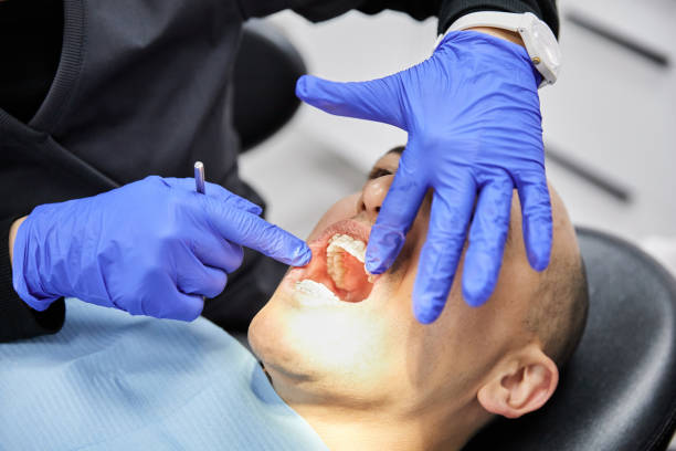 Best Emergency Dental Extractions in Redstone Arsen, AL